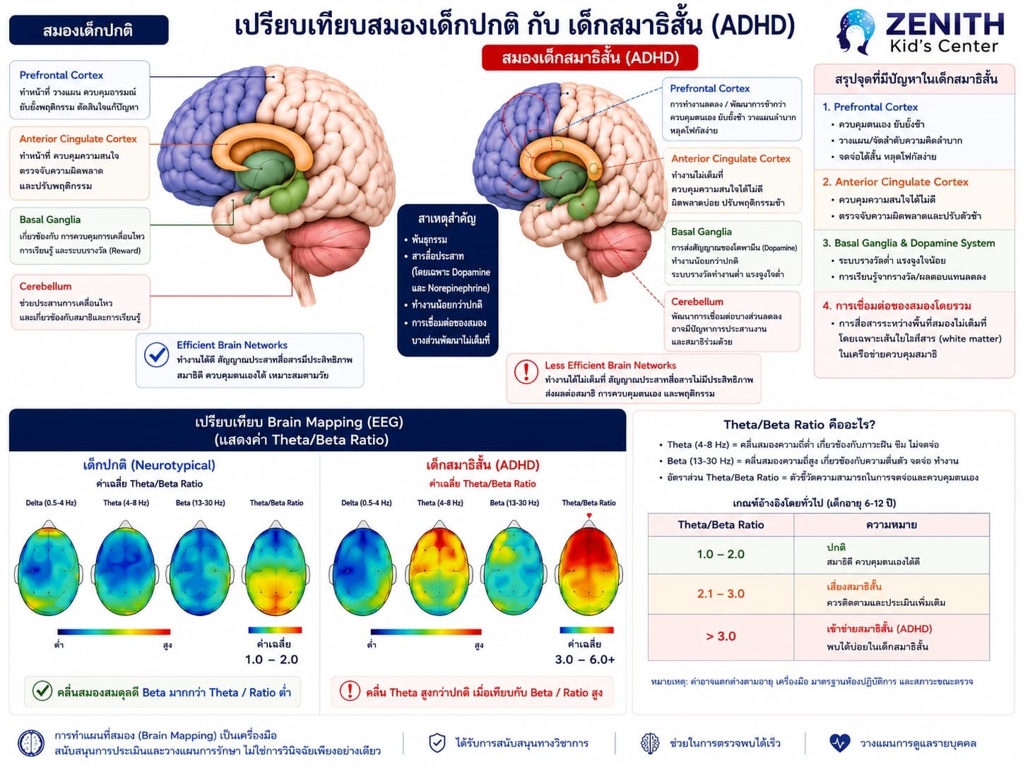 การตรวจคลื่นสมอง NDS ช่วยให้เราเข้าใจสมองของเด็กได้อย่างไร?